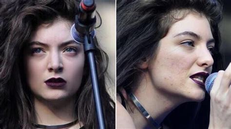 lorde bares her acne to prove flaws are ok