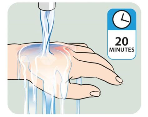 Hold the affected area under cold running water for three to four minutes. Treat minor burns with simple home remedies, February 3 ...
