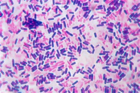 Mycoplasma Pneumoniae Gram Stain