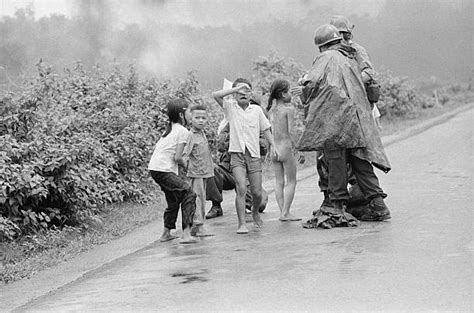 Boy And Girl Treated For Napalm Burns Pictures Getty Images
