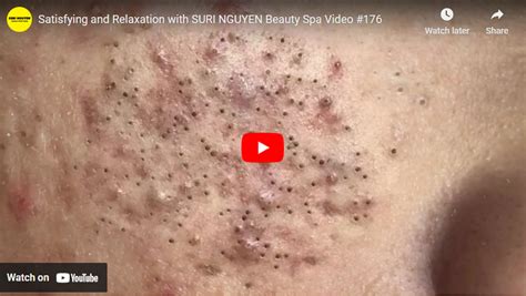 Satisfying And Relaxation With Suri Nguyen Beauty Spa Video 176