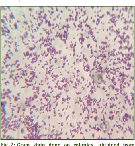 A Rare Case Report Of Corynebacterium Minutissimum Causing Bacteremia