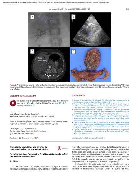 Pdf Percutaneous Stent Placement To Treat Coarctation Of Aorta Due To