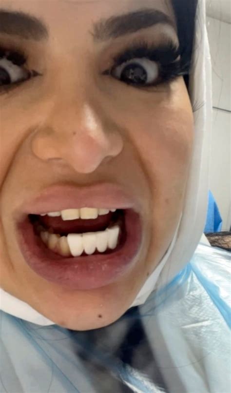 Young Woman Left With Lego Style Teeth After Botched Procedure Metro News