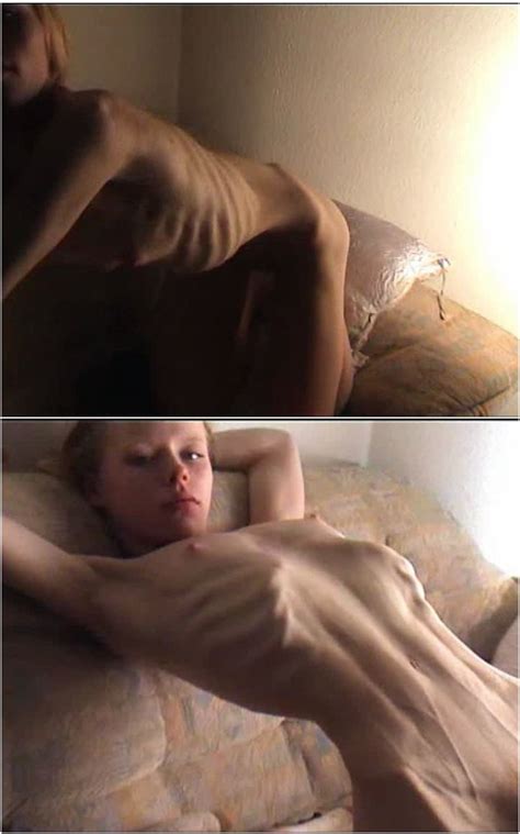 Extremely Skinny And Anorexic Softcore Posing Women Videos Fetish Pornbb