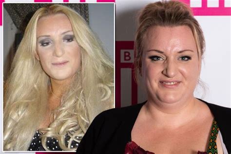 Daisy May Cooper Apologises To Fans For Weight Loss Post Showing Post