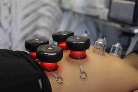 Best Cupping Therapy In Houston Cupping Therapy Near Me