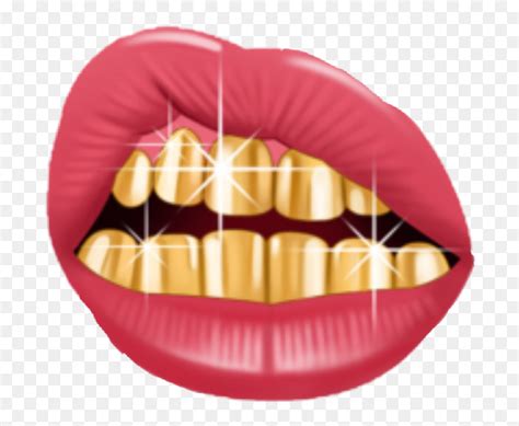 Mouth With Gold Teeth Ubicaciondepersonascdmxgobmx