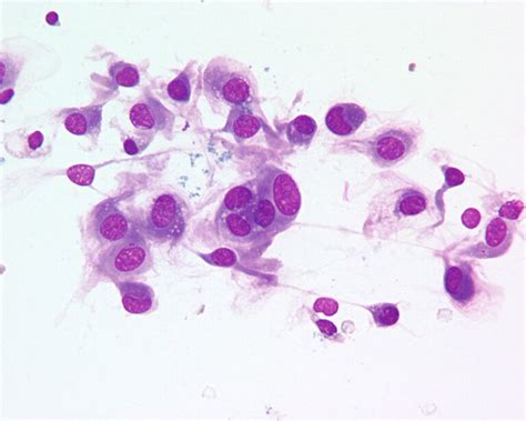Cytology Of Lumps And Bumps The Common Stuff Veterinary Medicine At