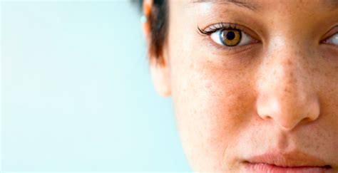 One leaf has also cracked. Top 10 Remedies For Brown Spots On The Skin | Search ...