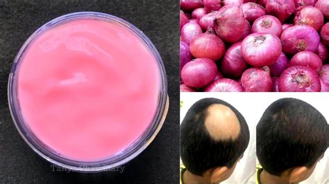 Diy Onion Hair Gel Onion For Hair Growth Grow Super Long And Strong