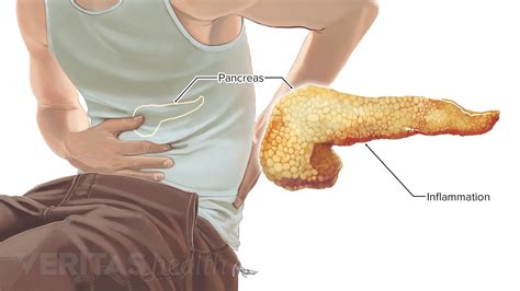 Left Side Upper Abdominal Pain And Nausea Ovulation Symptoms