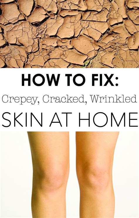 8 Images Home Remedy For Crepey Skin On Legs And Review Alqu Blog