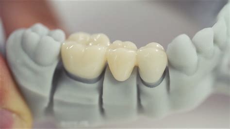 3d Printing The Mega Trend In Dentistry Dental News