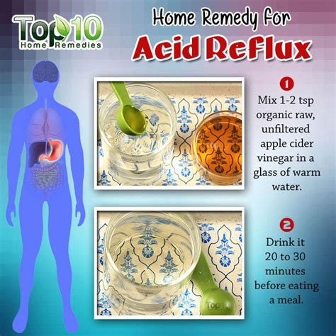 Home Remedies For Acid Reflux And Gerd Top 10 Home Remedies