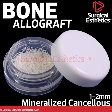 Ossif I Mineralized Cancellous Bone Allograft Large Particle