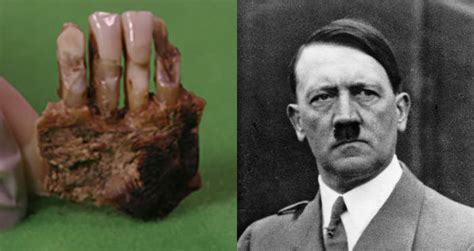 Disease Ridden Teeth Belonged To Hitler Scientists Confirm
