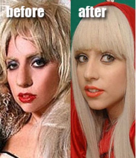 150 Before After Celebrİtİes Lady Gaga Plastic Surgery Lady Gaga
