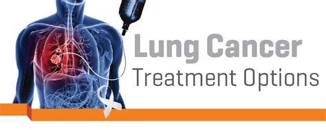 Different Treatment Options For Lung Cancer