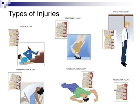 Ppt Spinal Trauma Powerpoint Presentation Free Download Id4562414