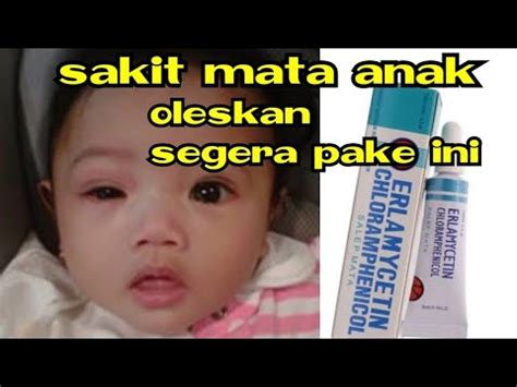Cara Menyembuhkan Sakit Mata Pada Bayi 5 Bulan - Bisabo ...