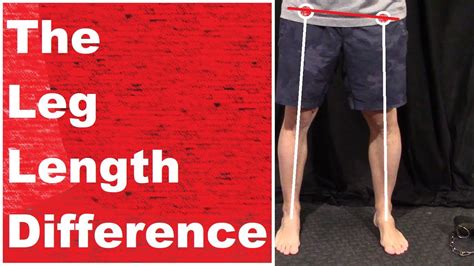 Leg Length Differences Youtube