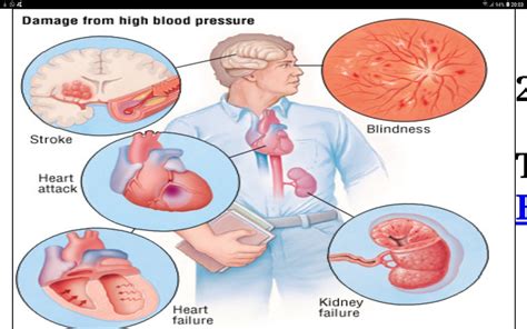 PSORIAZIS CORESPONDENTA DENIPLANT Hipertensiunea Arteriala Si