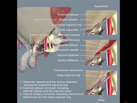 Inguinal Hernia Surgical Anatomy