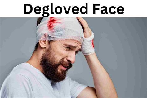 Degloved Face