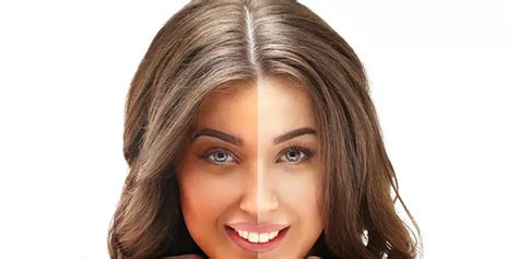 Skin Lightening Treatments Causes Effects Treatments And Results