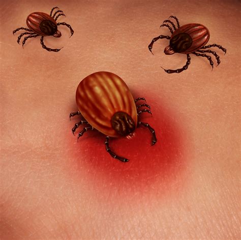 Enjoy nature this summer, but be on guard against ticks. Have you been bitten by a partially fed tick? - Daniel ...