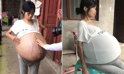 Chinese Woman Fakes Pregnancy With Artificial Belly Tries To Evade