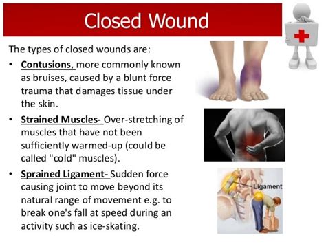 First Aid Bandaging Slideshow