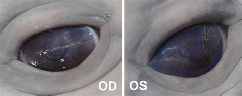 Characterization Of Anterior Segment Ophthalmologic Lesions Identified