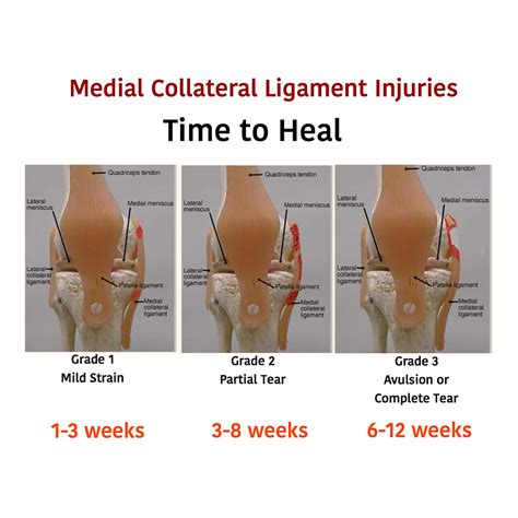 Medial Collateral Ligament Injury In Soccer Rehabilitation Weston