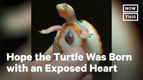 Hope The Turtle Was Born With An Exposed Heart Nowthis Youtube