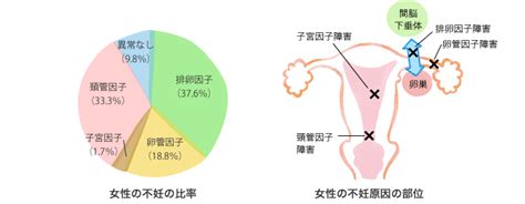 女性の不妊症と検査法 大阪の不妊治療専門 西川婦人科内科クリニック