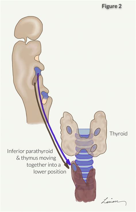 Parathyroid Anatomy Image 4 Hyperparathyroidism Surgery Dr Babak