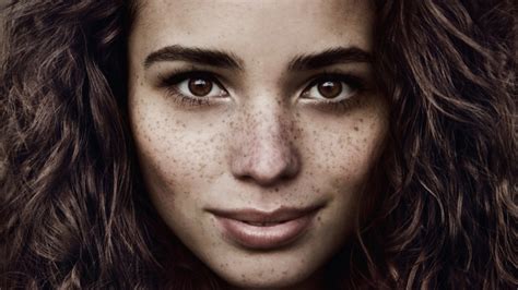The Truth About Freckles
