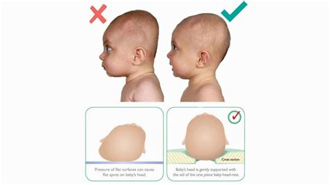How To Make Round Head Of A Baby Youtube