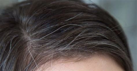 Premature Grey Hair In Teenagers Causes And Remedies