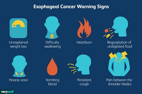 Esophageal Cancer Symptoms More