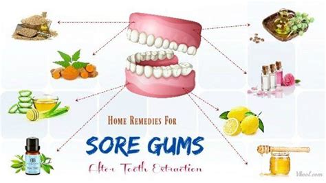 27 Home Remedies For Sore Gums After Tooth Extraction