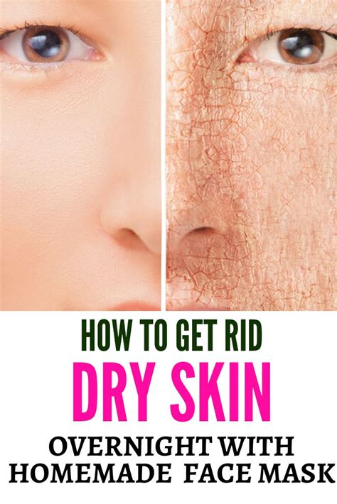 11 Natural Home Remedies For Dry Skin On Face Overnight Dry Skin Home