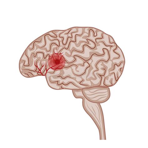 Cerebro Humano Enfermedades Del Cerebro Sistema Nervioso Ilustración