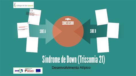 Síndrome De Down Trissomia 21 By Sónia Isabel
