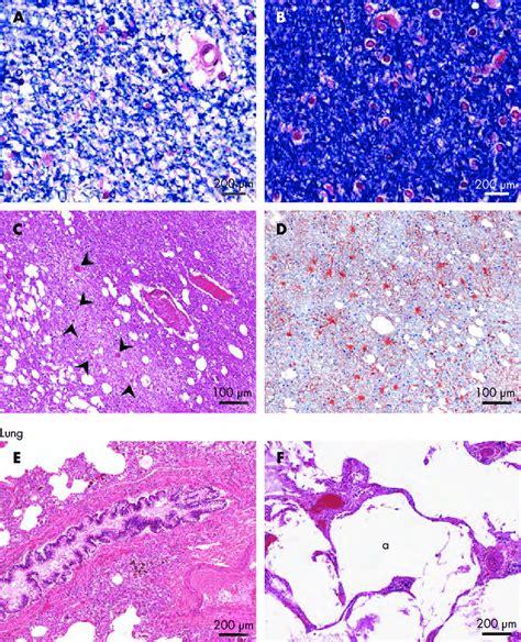 Histopathology And Immunohistochemistry Of The Brain And Lung Brain