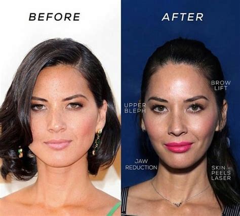 Actress Olivia Munn Never Admitted Plastic Surgery Before And After