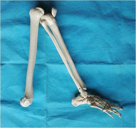 Zvcv Human Lower Limb Bone Model Educational Model Lower