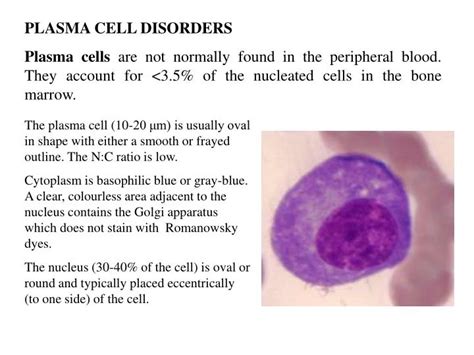 Ppt Plasma Cell Disorders Plasma Cells Are Not Normally